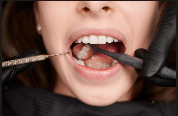 Best Painless Tooth Removal in South Mumbai